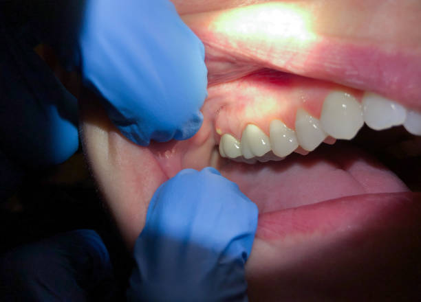 Best Emergency Cosmetic Dentistry in Pinecrest, FL